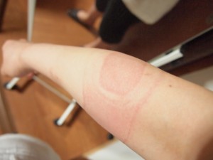 ソルボ Doエルボーバンド ブラック