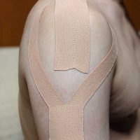 四十肩・五十肩の痛みを和らげるためキネシオテープを貼った様子